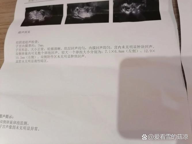 卵泡消失