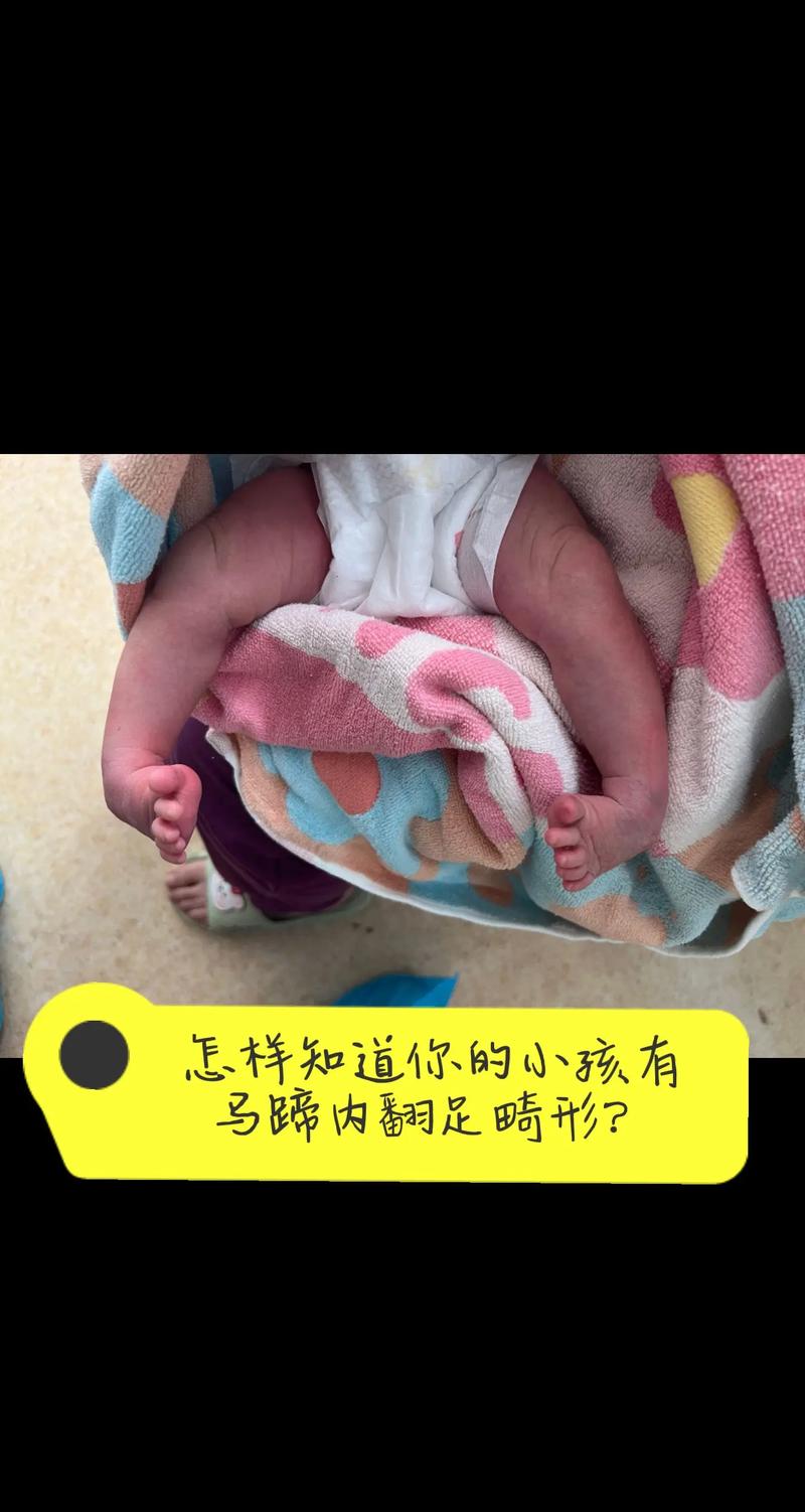 先天缺陷