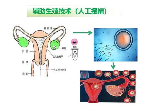 生殖应用