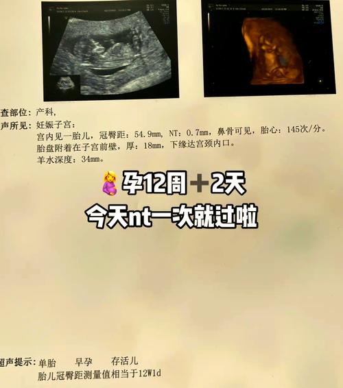 孕12周
