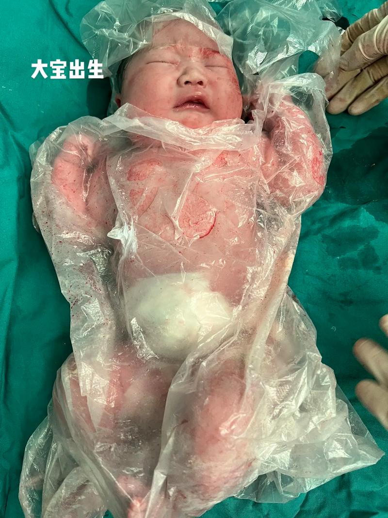 新生儿诞生