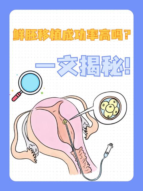 鲜胚胎移植