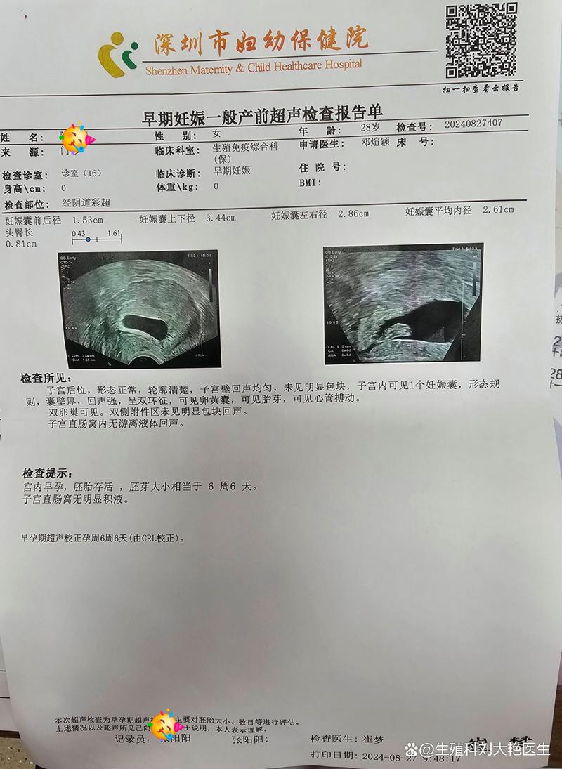试管婴儿彩超图像