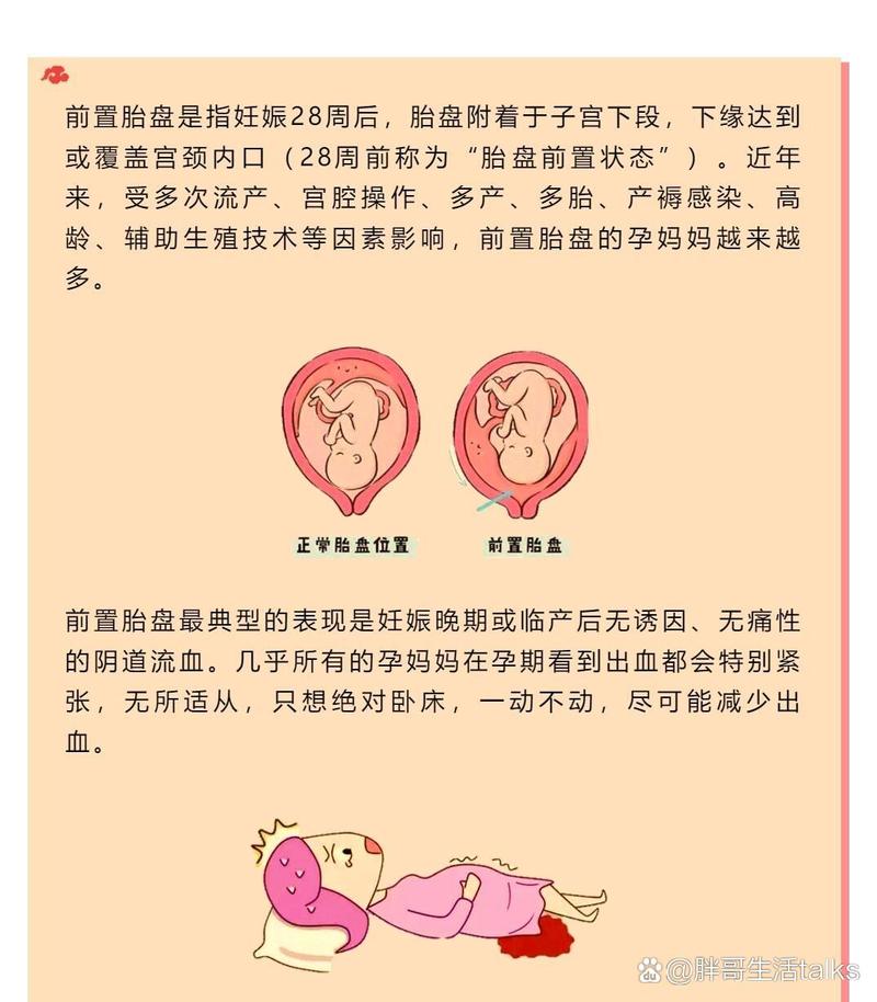 试管婴儿为何更易胎盘前置？