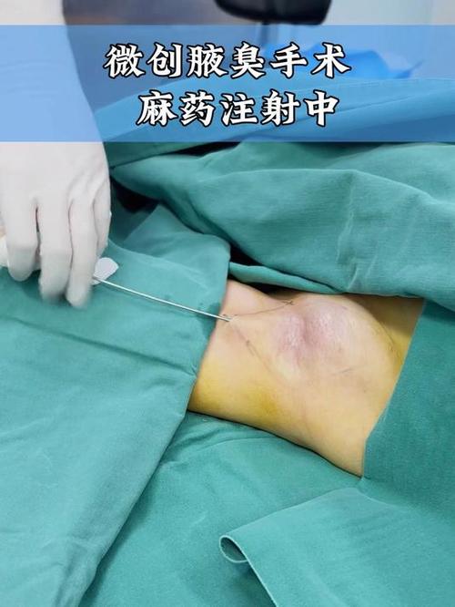 麻醉注射