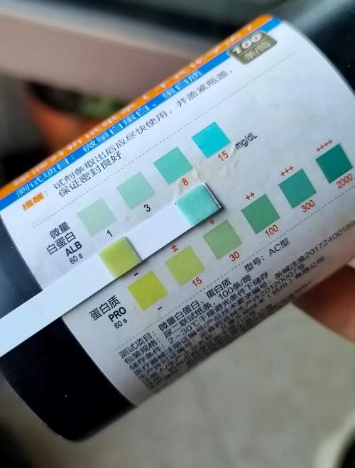 验尿颜色浅