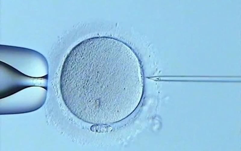 试管婴儿高清相册：从显微镜下看生命奇迹