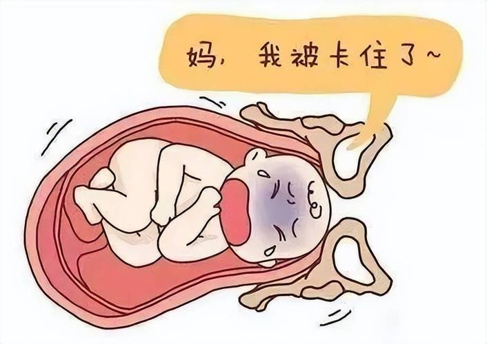 分娩难启动