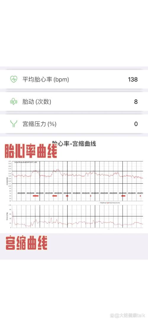 胎心率 184