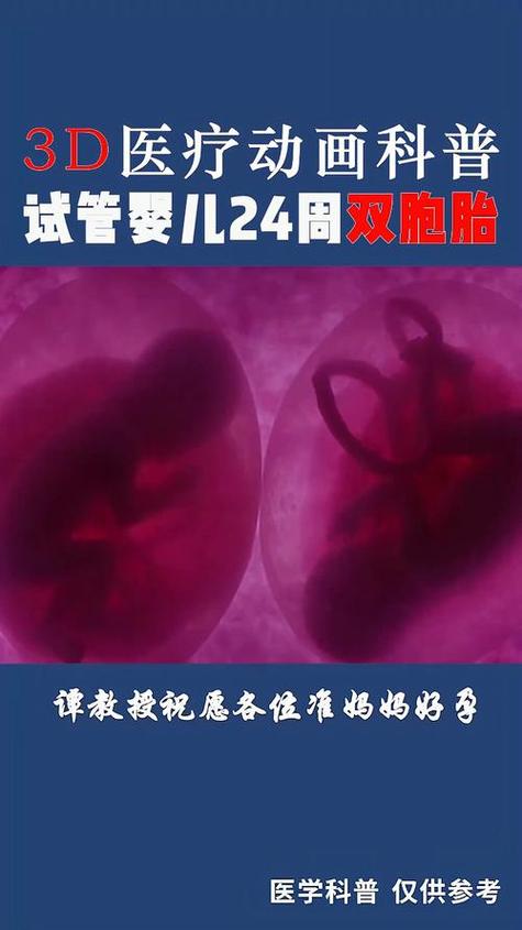 试管婴儿双胞胎技术
