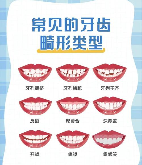 畸形类型