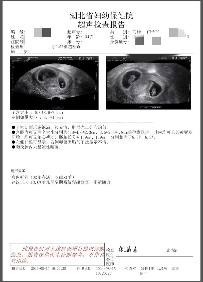 双胎怀孕