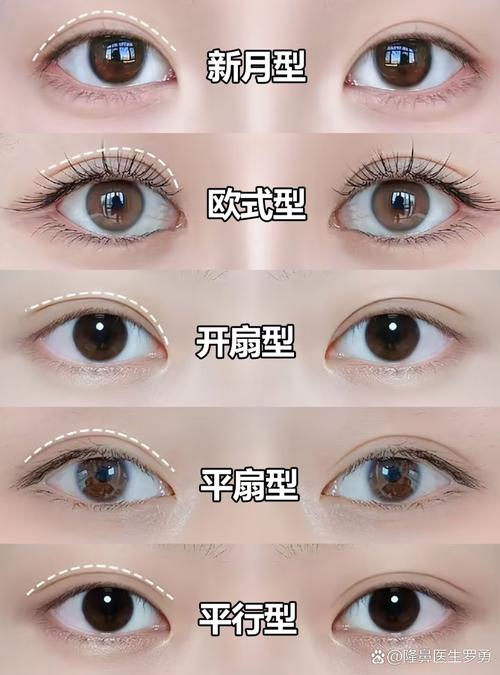 眼皮形态