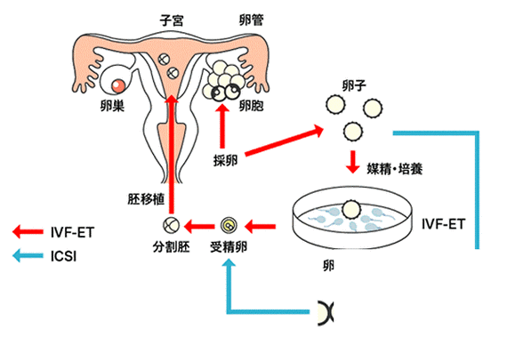 从试管婴儿到宝宝诞生：详解复原视频教程