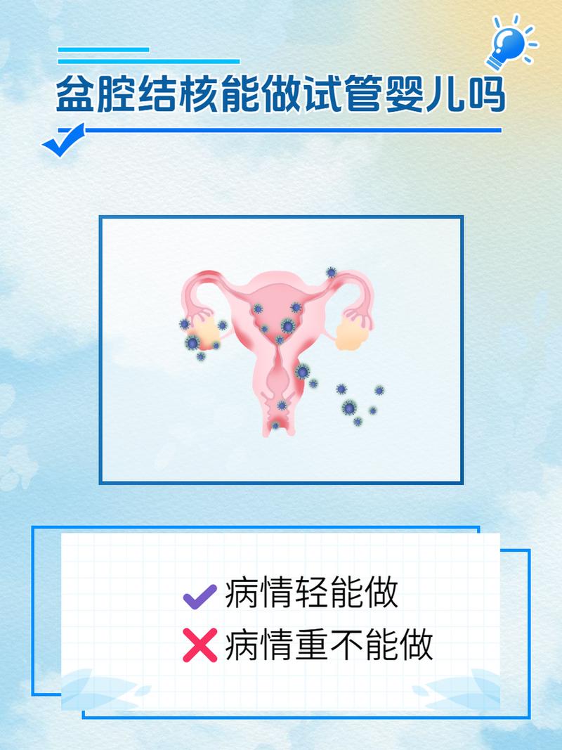 女性结核病患者适宜做试管婴儿吗？