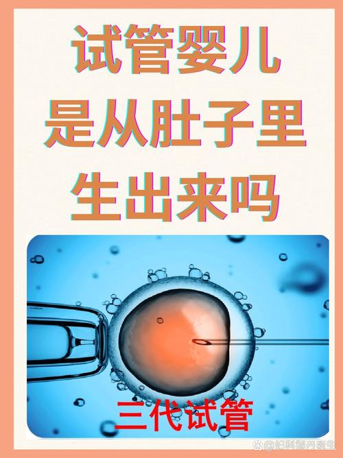 试管婴儿过程中，超为何要压迫腹部？