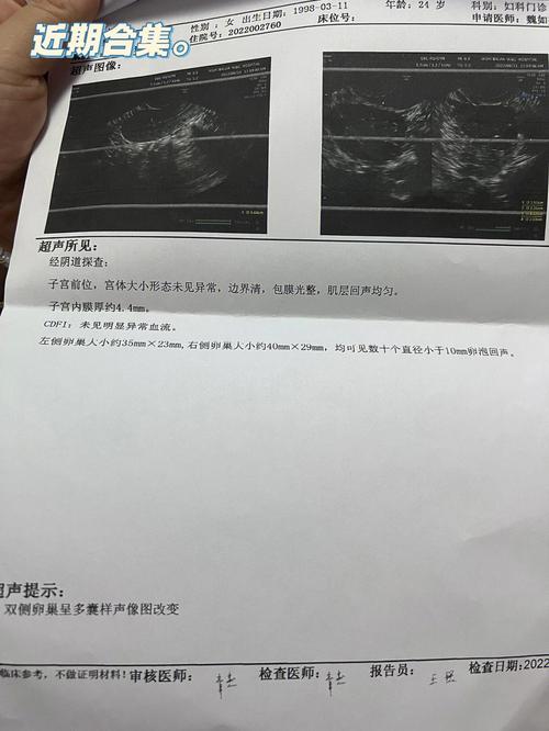  月经后检查