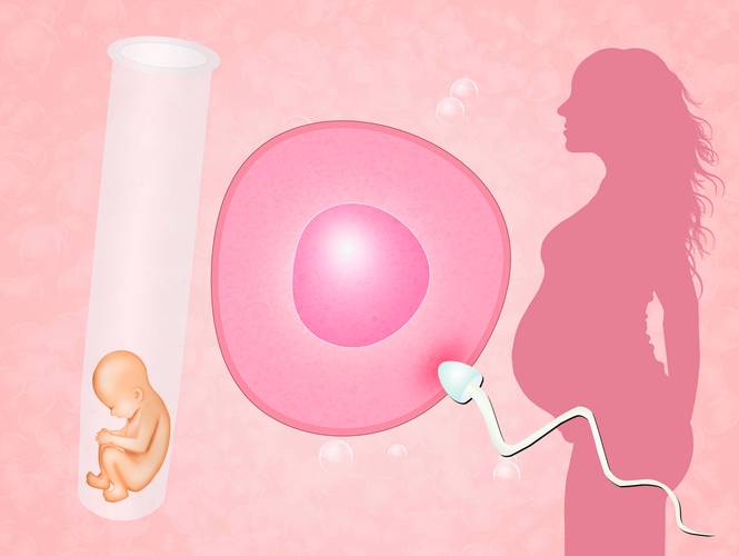 试管婴儿生殖健康