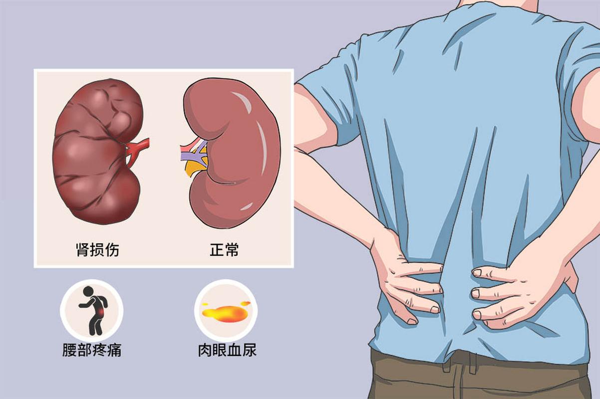 肾脏疾病
