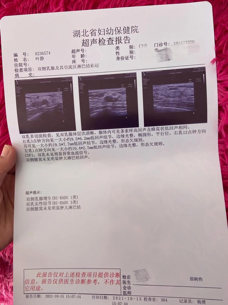 乳腺纤维囊肿