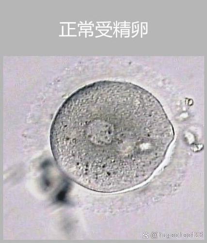 授精卵3级