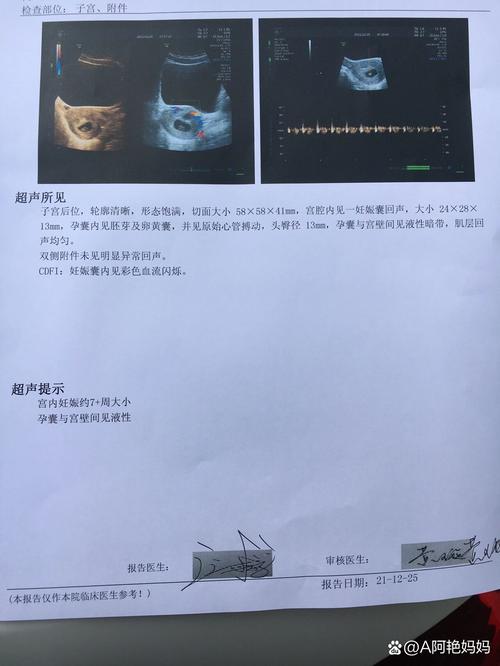 孕囊胚芽偏小
