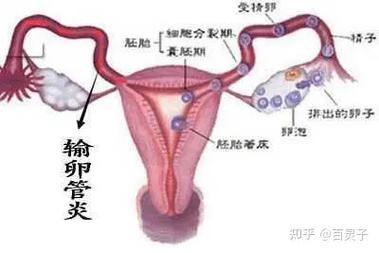  输卵管