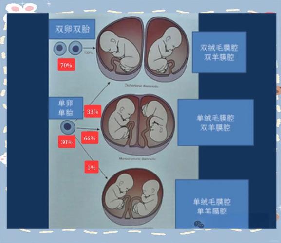  单卵双胎