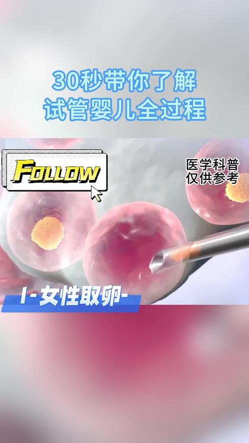 女生试管婴儿过程