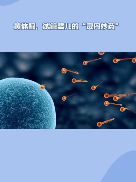 试管婴儿治疗中黄体酮剂量的精准调整与影响