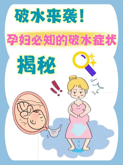 破水