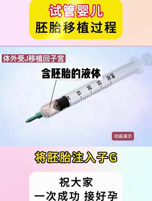 试管婴儿移植过程详解：如何安全送回母体？