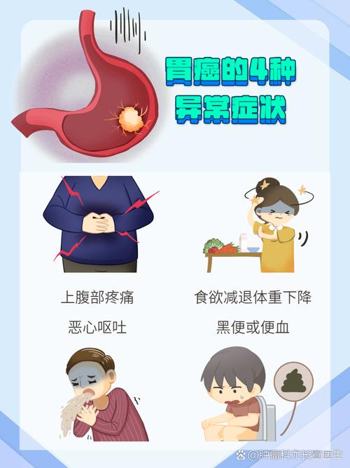 胃癌风险