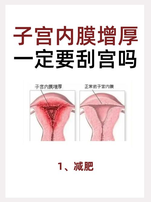 内膜准备
