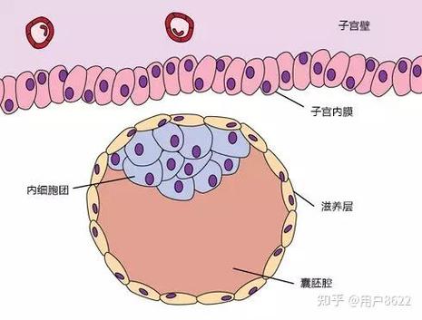 试管婴儿过程中宫内絮状物的形成及影响分析