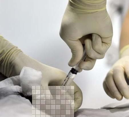 试管婴儿过程中为什么需要抽取别人的血？