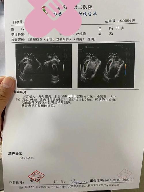 7周试管婴儿