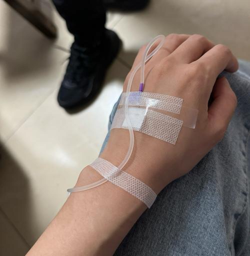 吊针体验