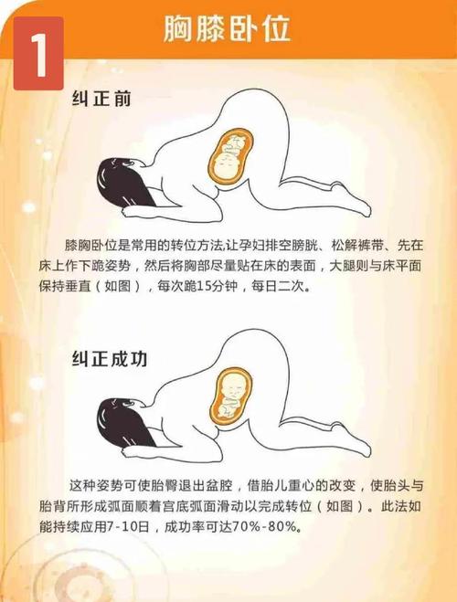 胎位过高