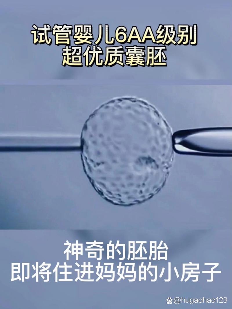 囊胚试管婴儿