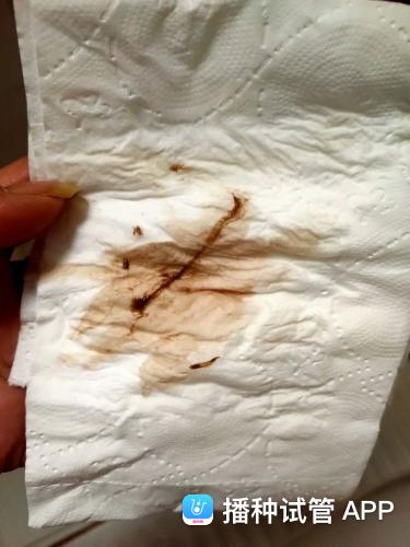 试管婴儿出血是褐色正常吗？了解真相！