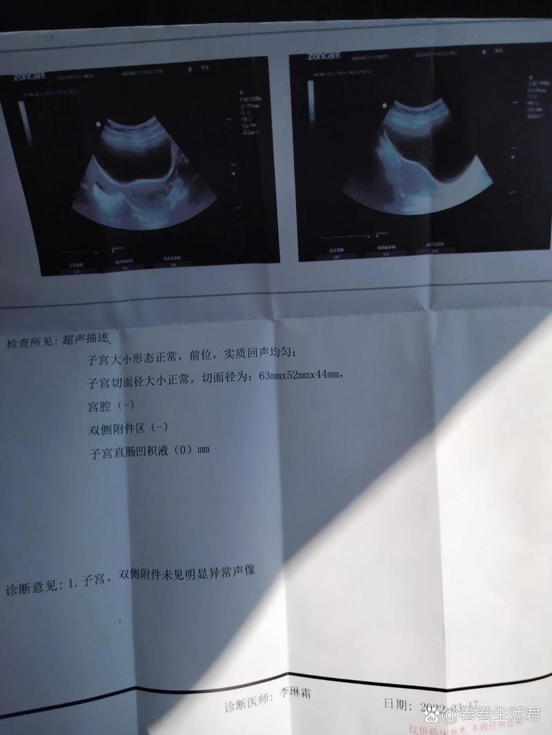 月经检查