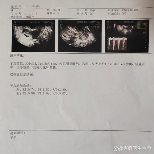 20天彩超检查