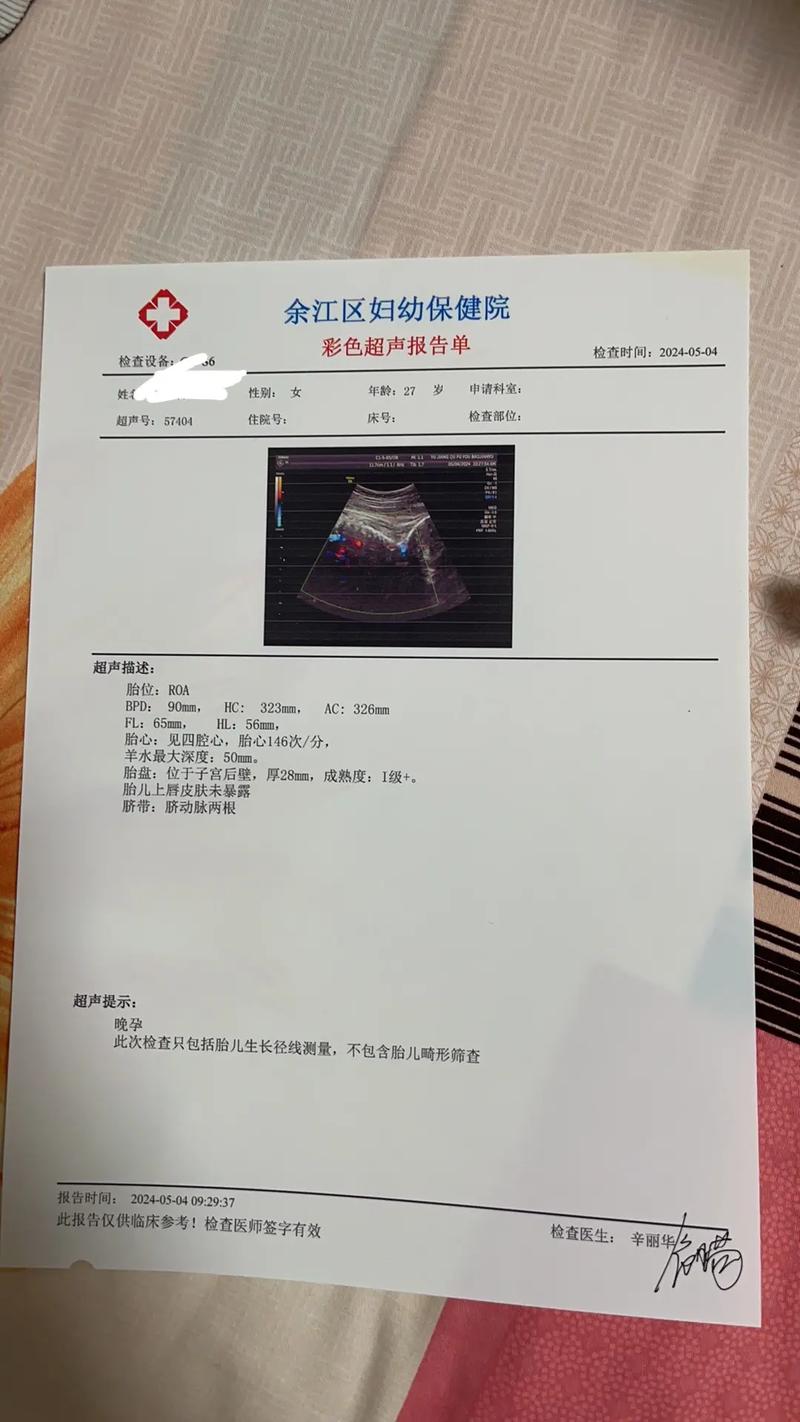  彩超检查