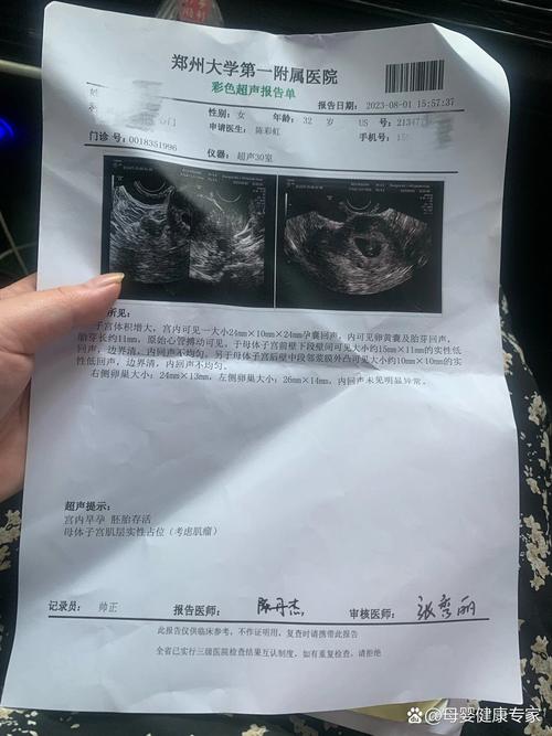 移植35天超