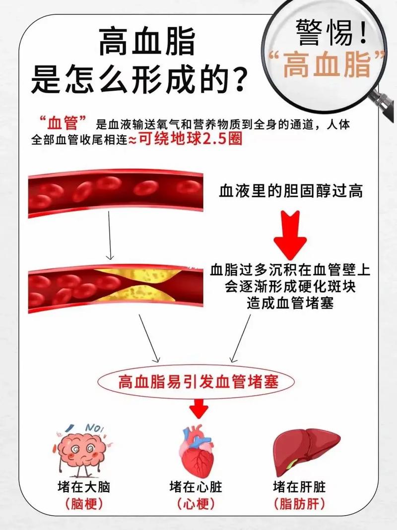 血脂异常