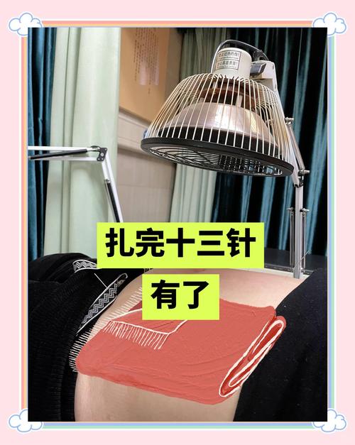 在试管婴儿移植前，针灸有何作用？