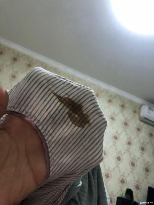 试管婴儿移植后排出黑血是什么情况？