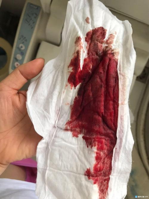 试管婴儿孕期流血多久算正常？