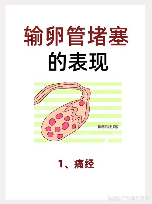 输卵管堵塞无法自然受孕？试管婴儿来帮忙！